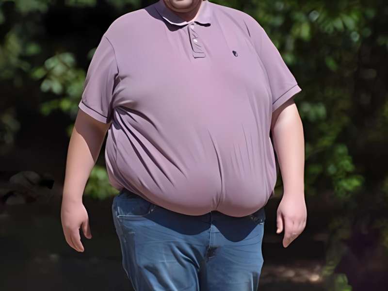 Morbid Obezite Tedavi Operasyonu